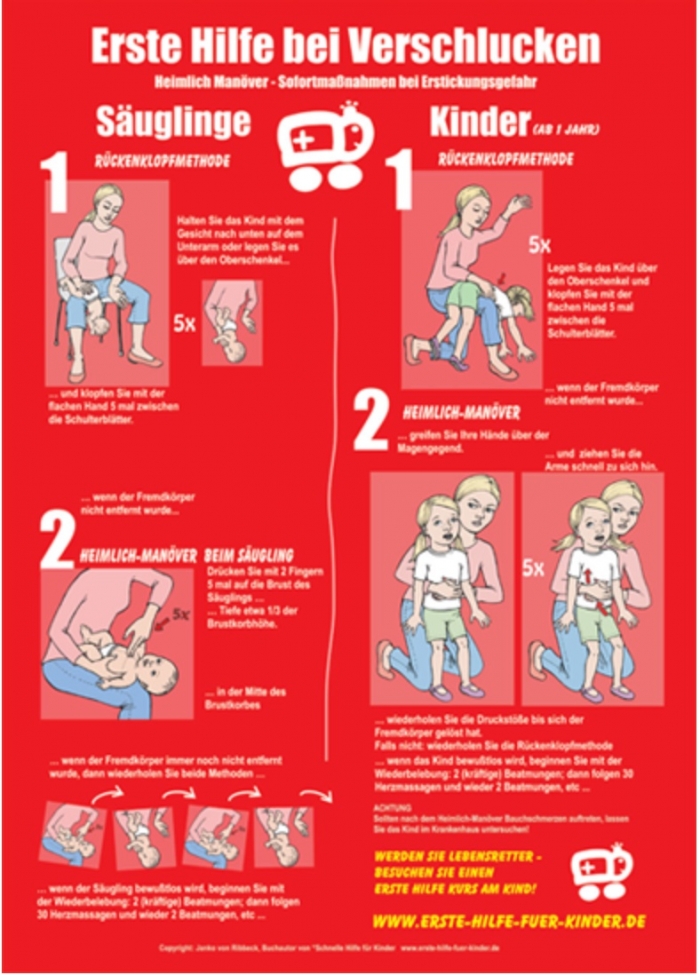 P3K ketika tersedak (dok.Erstehilfe.de)