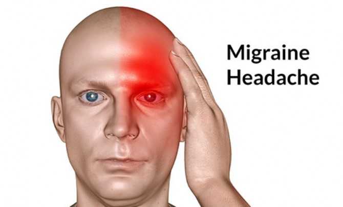 Apa itu migrain