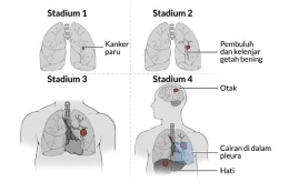 Bentuk paru-paru manusia | Sumber: alodokter.com