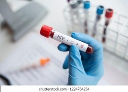 Ilustrasi tes HIV/AIDS foto via shutterstock