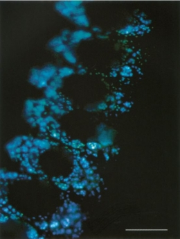 Ujung lengan Vampyroteuthis infernalis berpendar di bawah mikroskop fluorescence [Sumber: Robinson dkk. 2003: 108] 