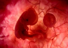 Embrio Manusia Dalam Rahim Sang Bunda | IslamPos