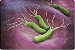 Infeksi Helicobacter pylori. Sumber: via news.unair.ac.id