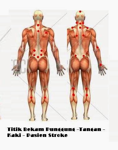Terapi stroke tangan dan kaki kanan