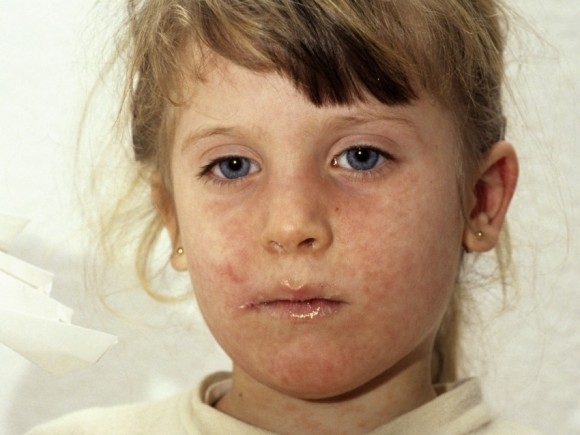 14276944811045730181 14276944811045730181