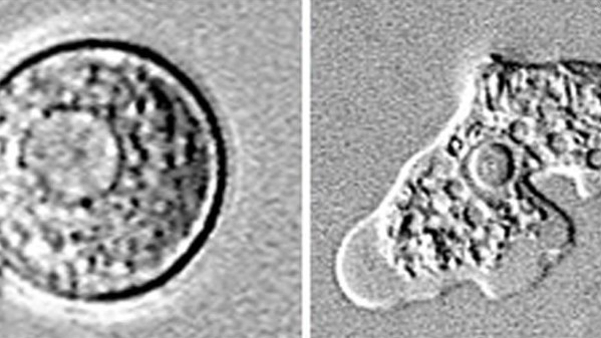 Amuba Pemakan Otak Manusia Diidentifikasi Setengah Abad Amuba Pemakan Otak Manusia Diidentifikasi Setengah Abad