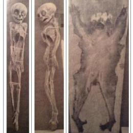 Foto 2: Kerangka anak orang pendek (tampak depan dan samping) dan kulitnya. Sumber: Pandji Poestaka, No. 49, Tahoen X, 17 Juni 1932, hlm. 758 [Serba-Serbi].