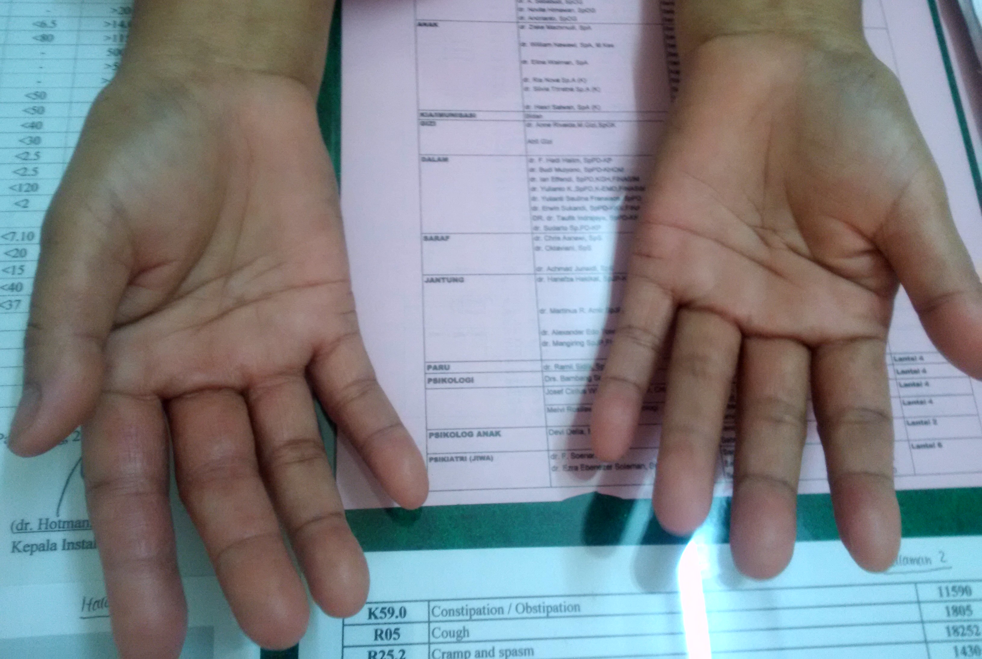 tangan pasien dermatitis alergi (dokumentasi pribadi)