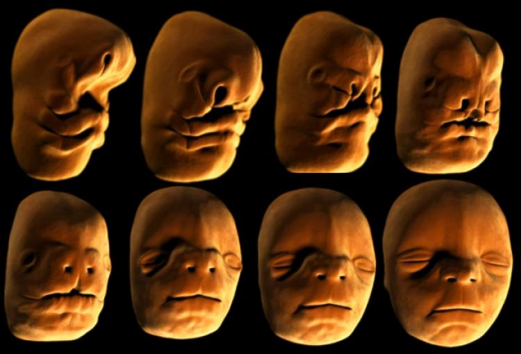 Profil wajah kita sudah terbentuk pada usia kandungan 4 minggu. Sumber: www.evrimselantropoloji.org 