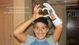Seorang bocah di Argentina senang dengan kehadiran tangan barunya, FOTO: enablingthefuture.org 