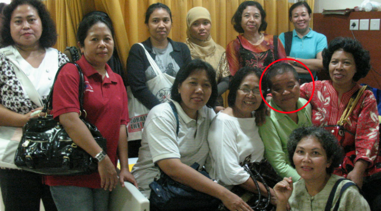 Sosok Ibu Pur (lingkaran merah) yang menderta kanker payudara. Dok. SOS Children's Village