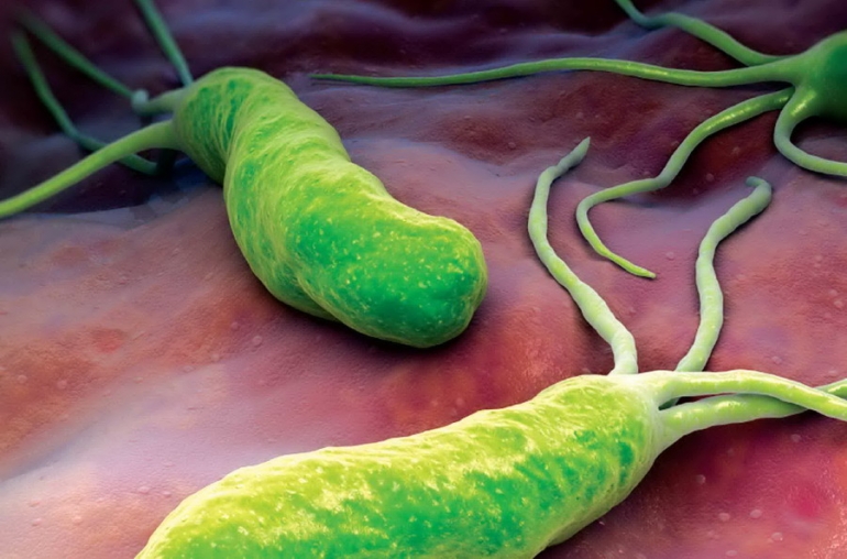 Helicobacter pylori, bakteri senyap yang setiap saat bisa menginfeksi saluran pencernaan (https://www.systemsbiology.org).