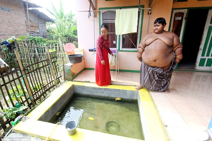 Arya Permana bocah asal Karawang yang mengalami severe obesity. (Foto: Caters News Agency) 