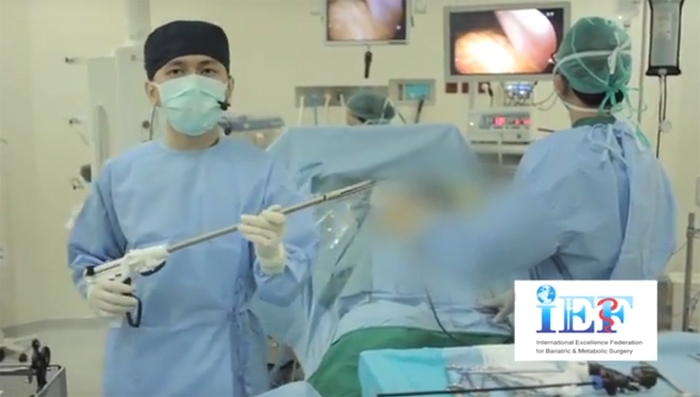 Dr Handy Wing SpB menunjukkan salah satu alat Operasi Bariatric Surgery dengan Teknik Laparoskopi. (Foto: bedahobesitas.com)