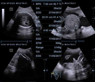 Usg 4 Dimensi Kehamilan Halaman All Kompasiana Usg 4 Dimensi Kehamilan Halaman All Kompasiana