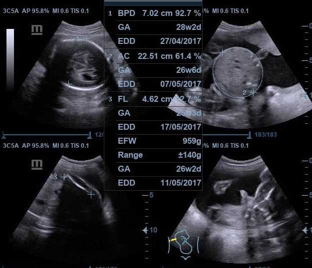 Usg 4 Dimensi Terdekat Usg 4 Dimensi Terdekat