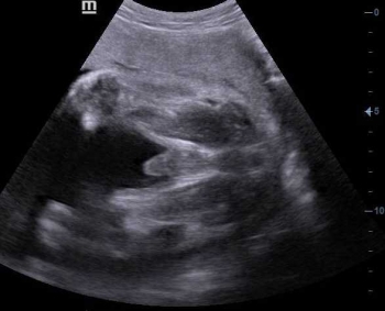 Usg 4 Dimensi Kehamilan Halaman All Kompasiana Com Usg 4 Dimensi Kehamilan Halaman All Kompasiana Com