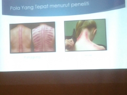 Pola Kerokan yang dianjurkan oleh Peneliti. Dok. Presentasi Prof. Dr. Didik Gunawan Tamtomo