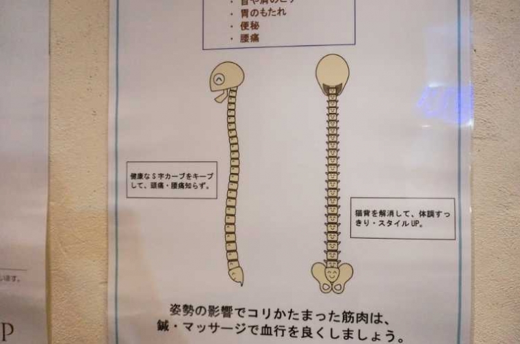 Gambar tulang di klinik. Tulang lho ini. (Dokpri)