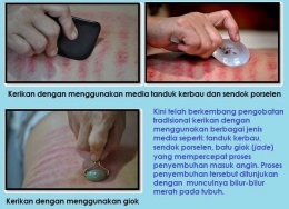 Berbagai media yang digunakan untuk kerikan (Sumber: bahan presentasi Prof.Dr.dr. Didik Gunawan Tamtomo. PAK, MM, Mkes.)