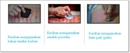 Berbagai benda tumpul untuk kerokan. Sumber : Materi Presentasi Prof. Dr. dr. Didik Gunawan Tamtomo