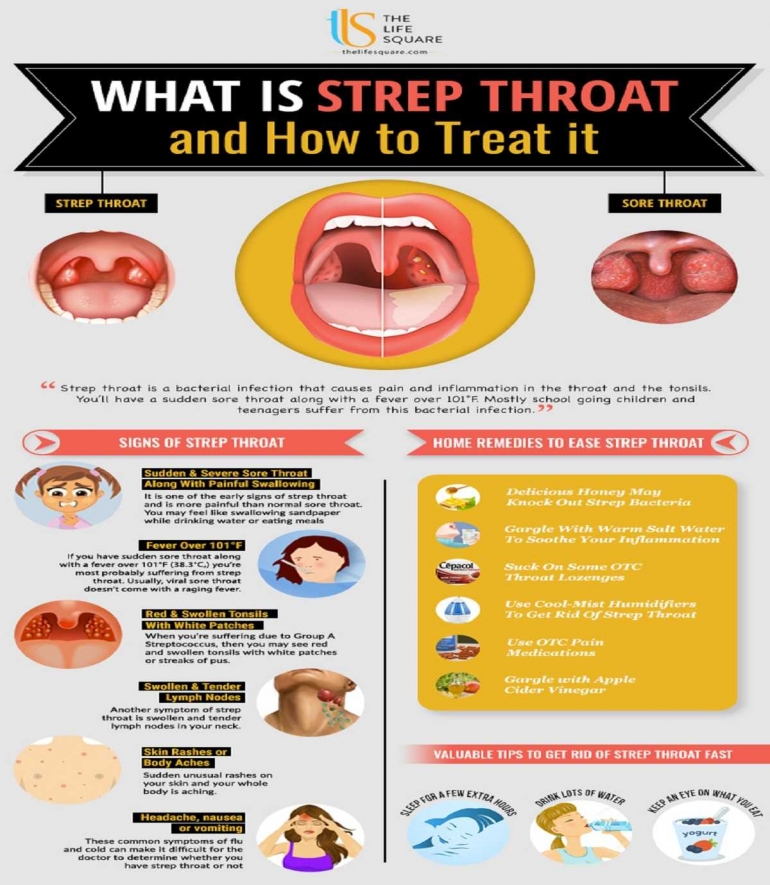 (Gambar 7: Rangkuman Mengenai Strep Throat; Sumber gambar: https://thelifesquare.com/