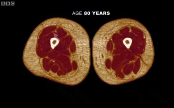 Otot (Merah) dibandingkan dengan lemak pada paha orang berumur 80 tahun Sumber : Screenshot BBC Earth