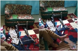 Kepala Sekolah SMPN 4 Lolak Sulawesi Utara Astri Tampi terluka parah usai dianiaya seorang wali murid. (Alfred Bustian Kaemba)