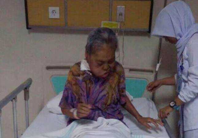 Dalam perawatan di RSUP Karyadi Semarang (foto: dok pri)