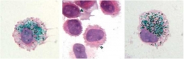 Pigmen hijau sel macrophage (kiri) walaupun sudah dimatikan dengan laser (tengah) ternyata berhasil menyebarkan warna hijau tato ke sel baru (kanan). Photo: Baranska et al., 2018 
