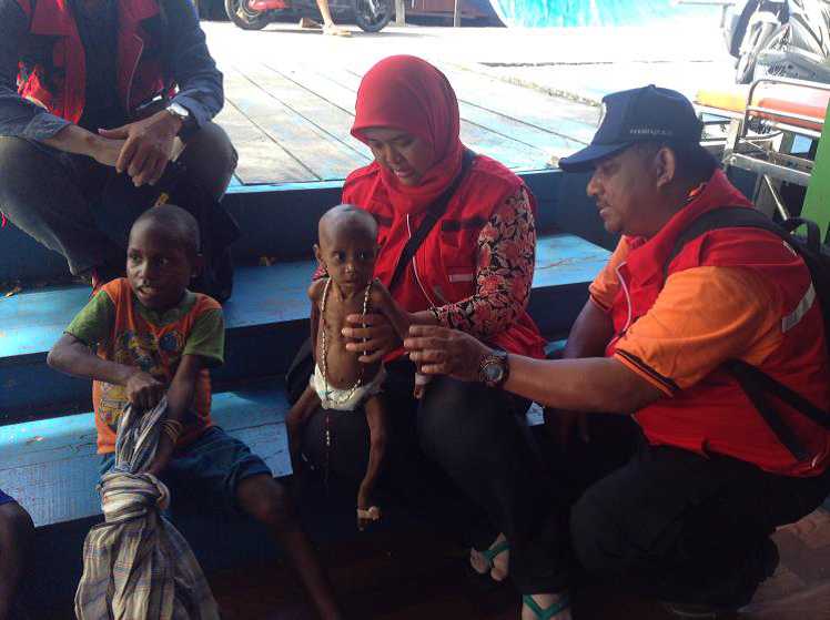 Pasien Gizi Buruk di Kabupaten Asmat