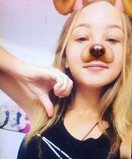 Emily stick ,gadis yang mengakhiri hidupnya ,lantaran di bully teman teman /ilustrasi :https://9News.com.au