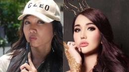 Lucinta Luna Sebelum dan Sesudah (Detikhot.com)