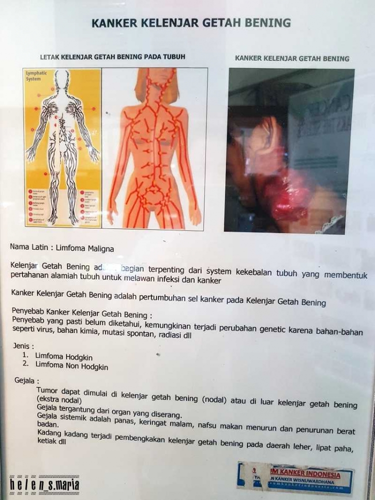 Museum Kanker Indonesia