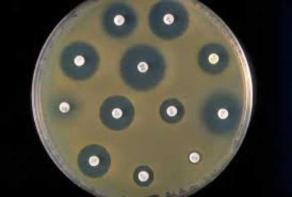Gambar 2: Uji Kepekaan Kuman terhadap antibiotik di laboratorium. (Sumber: https://reflectionsipc.com/)