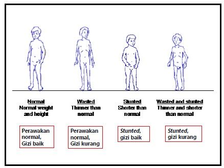 Tentang Stunting di Indonesia, sumber gambar dr. Klara Yuliarti, SpA (K)