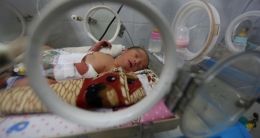 Bayi prematur dirawat di inkubator di unit perawatan anak di sebuah rumah sakit di Sanaa, Yaman (Sumber: irishtimes.com/Khaled Abdullah/Reuters)