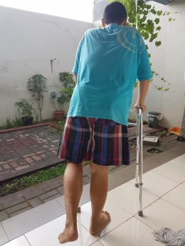 suami tercinta saya pasca operasi, masih menggunakan alat bantu untuk berjalan|Dokumentasi pribadi 