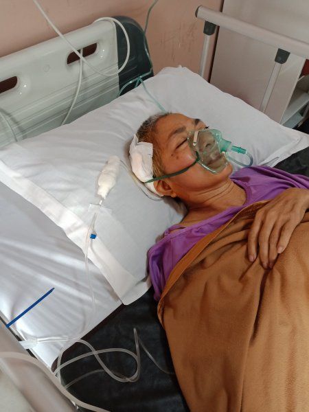 Dua Belas Kali Operasi Bedah Saraf Gratis Berkat Bpjs Halaman All Kompasiana Dua Belas Kali Operasi Bedah Saraf Gratis Berkat Bpjs Halaman All Kompasiana