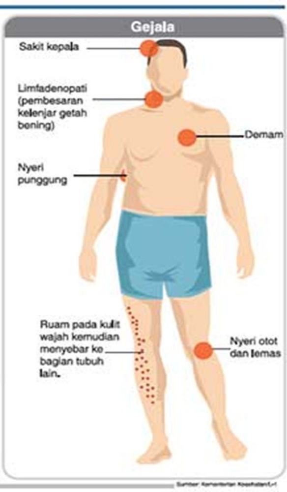 Gejala Cacar Monyet (Sumber: Kemenkes RI, 2019)