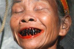 Ilustrasi gigi hitam karena menyirih( foto Poskupang.com)