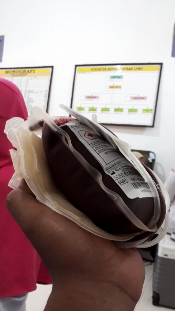 Kantong darah oleh salah satu mahasiswa KKN UM yang ikut mendonorkan darahnya | dokpri