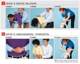Back blows & Abdominal Thrusts (Sumber: American Red Cross)