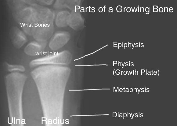 Ilustrasi growth plate, cedera akibat olahraga fitness (Sumber : www.davidlnelson.md)