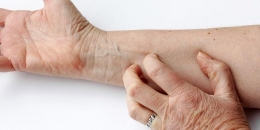 Kulit gatal? Mungkin ini beberapa penyebab yang membuat kulitmu gatal. | dw.com