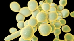 Candida auris. Photo: Science Photo Library/BBC