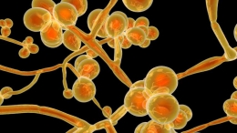 penampakan Candida auris. Sumber: Getty images