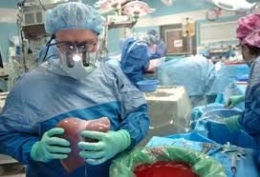 Transplantasi membuka jalan untuk mutasi DNA dan perkembangan sel yang tidak terkontrol. (sumber: ibj.com)