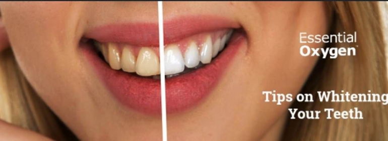 sumber gambar:  https://essentialoxygen.com/tips-whitening-teeth/