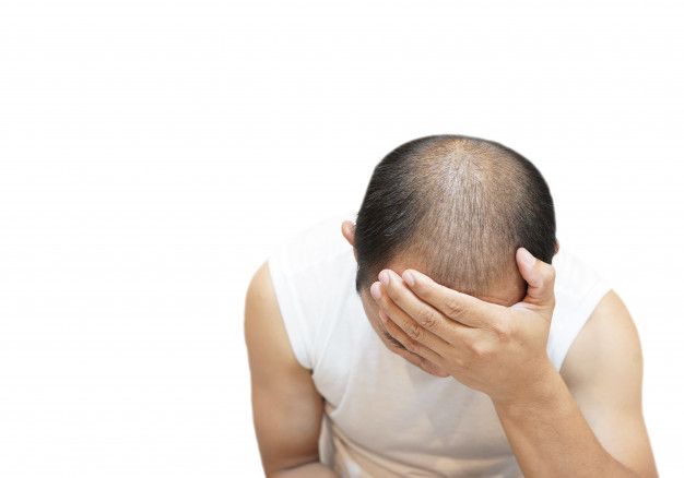 Bahaya Rambut Rontok yang Berlebihan bagi Kesehatan